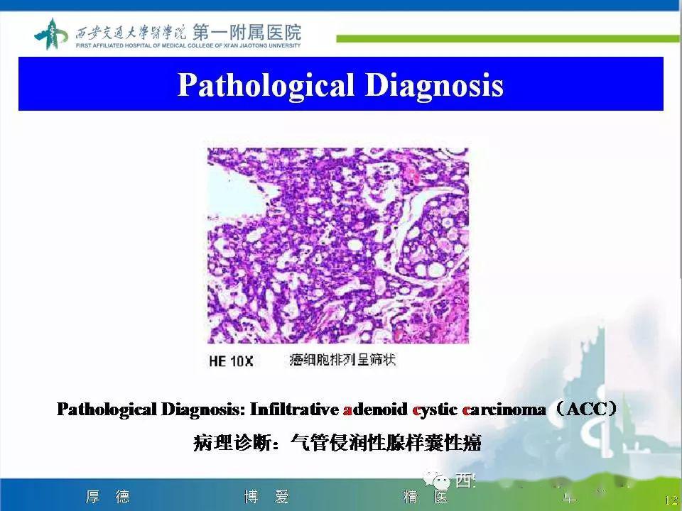 精彩病例 | 气管腺样囊性癌