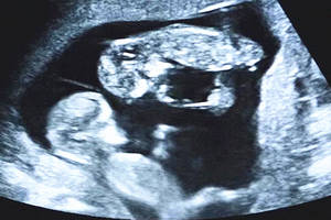 开团|讲真,这款宝宝推车妥妥击败那些 "婴儿车里的