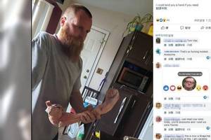 男子遇车祸舍不得断肢,让虫子啃咬手臂的肉,制作成白骨标本