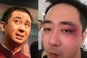 王自健被散打冠军前妻家暴细节曝光,扇耳光烫烟头,日常鼻青脸肿