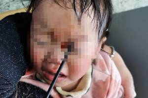 筷子粗的塑料杆戳进女童眼睛,直插颅脑!这些网红玩具别再给孩子买了