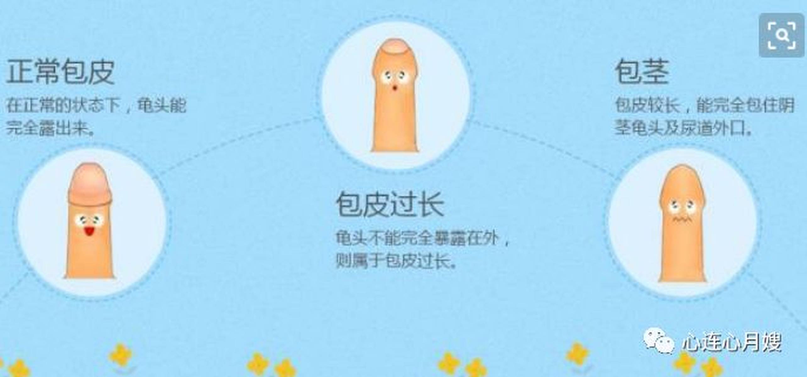 家有男宝必看！和小鸡鸡相关这几件事，一定要了解!
