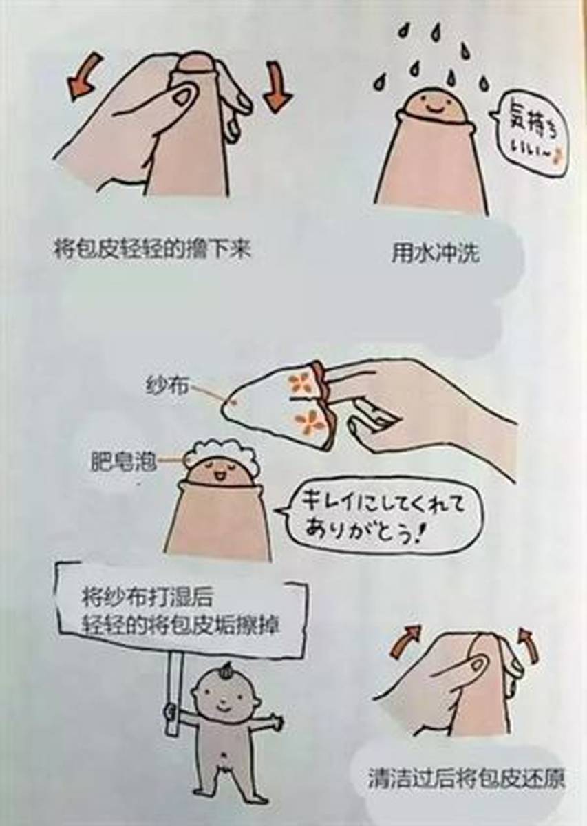 寒假快来了，又到了男孩们排队割包皮的季节！许多家长都会纠结：男孩子都要割包皮吗？