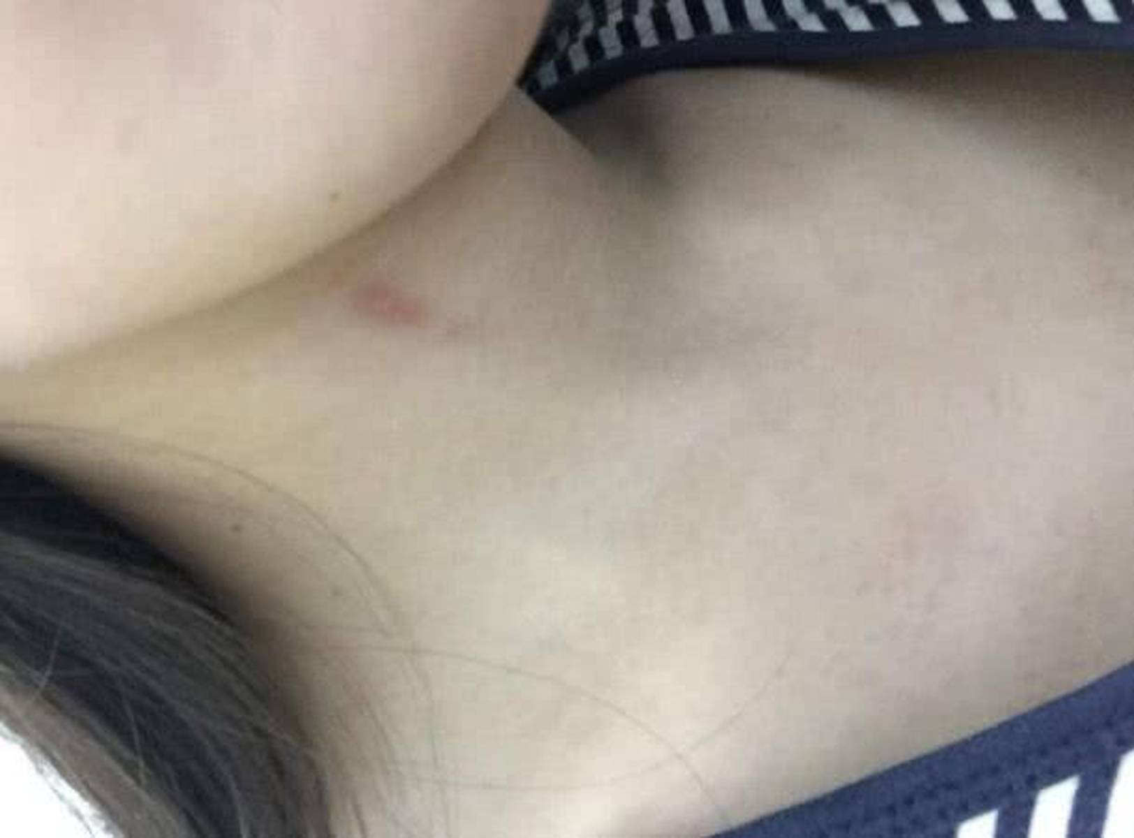 亲吻时，在脖子上留下吻痕，带来的这2个影响你要清楚！