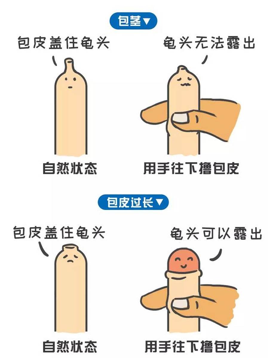 男宝到底要不要割包皮？几岁割？弄清楚这些问题很重要