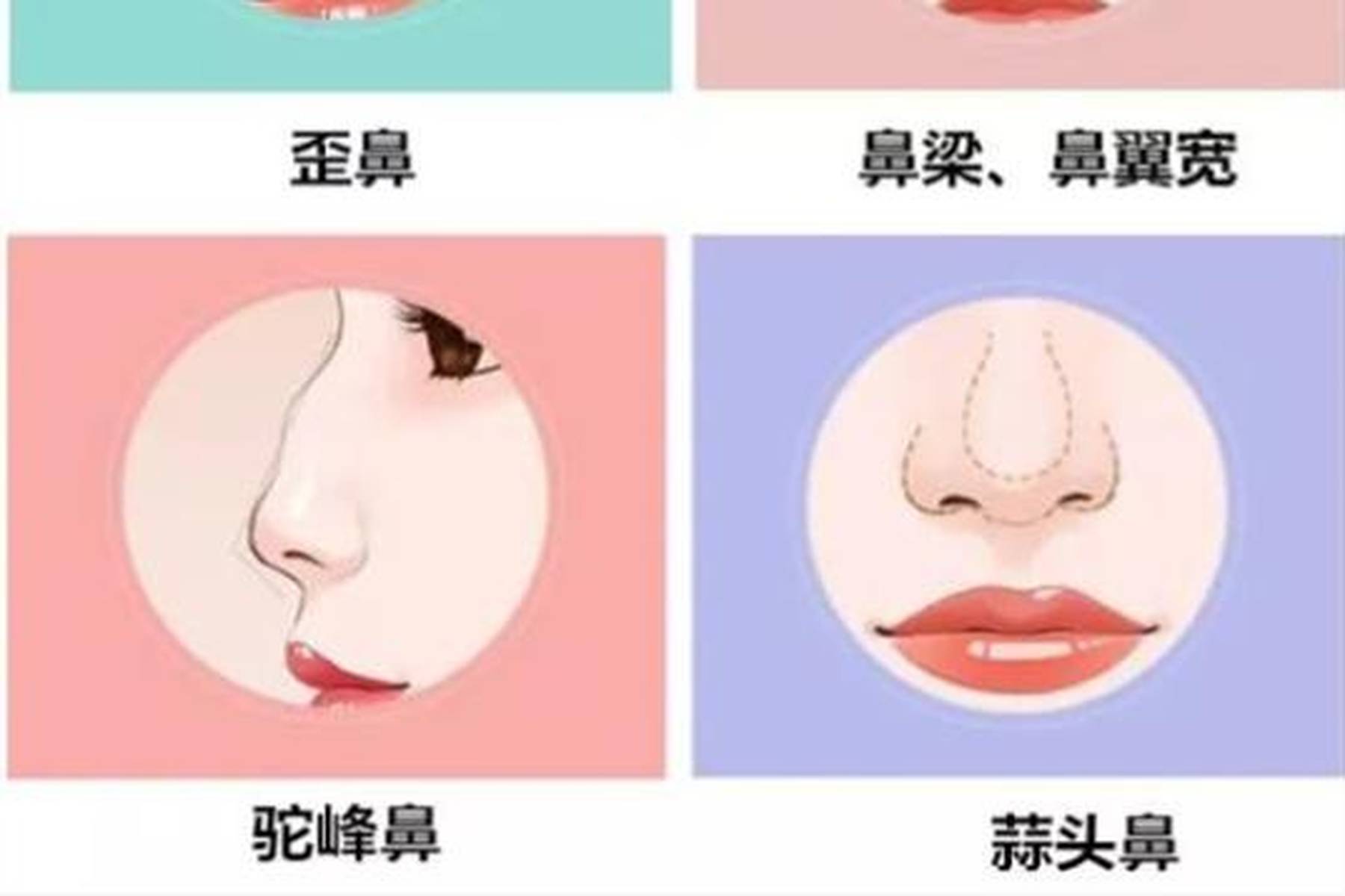 你是什么类型的鼻子？对号入座~