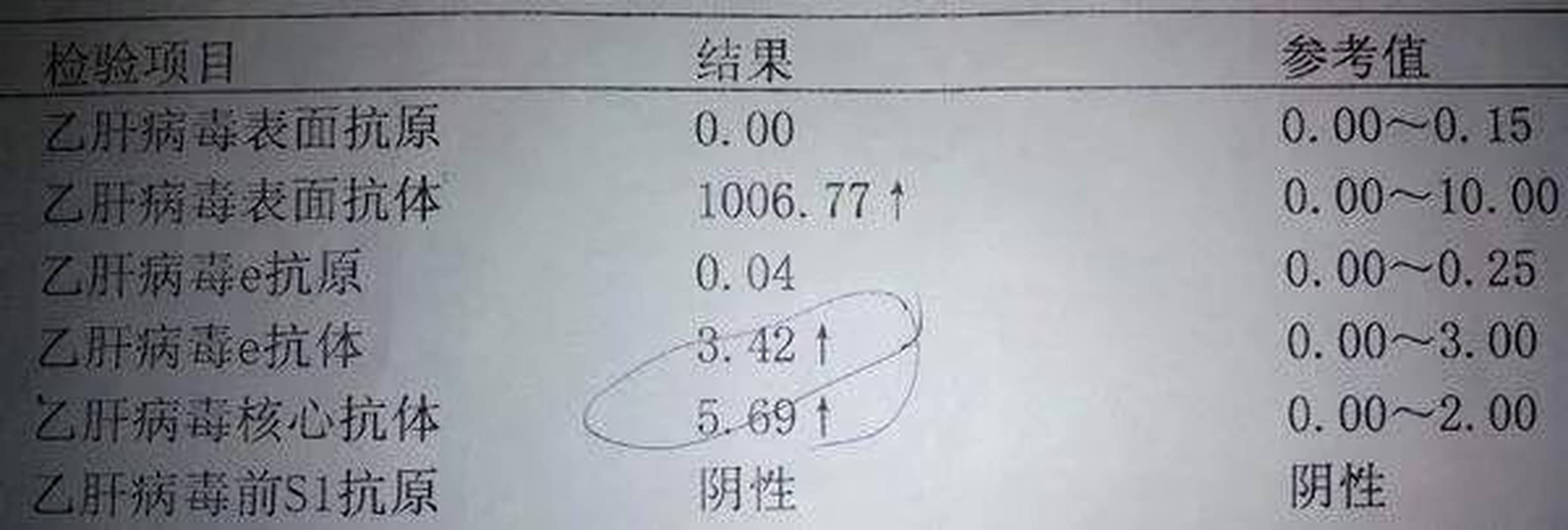 乙肝自愈后，没有产生抗体或抗体滴度不高，还需要打乙肝疫苗吗？