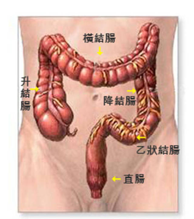 女白领的难言之隐,大便带血怎么办!