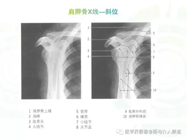 肩关节解剖,没你想的那么复杂