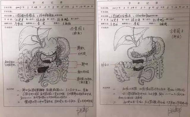 他做手术后,会在你病例上留下一副精美的手绘画!