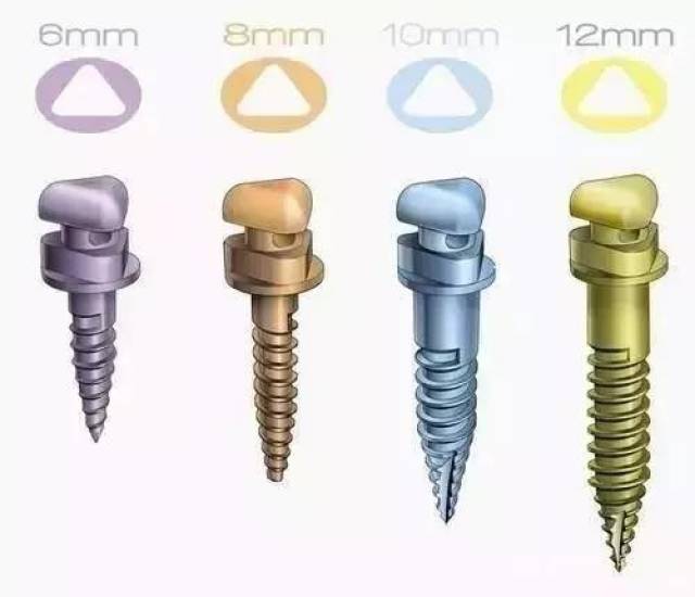 正畸牙齿竟然要打骨钉!那是什么玩意?