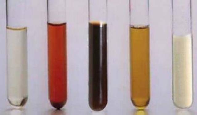 尿液如同酱油一样的棕褐色,可见于急性肾炎,急性黄疸型肝炎,肾脏挤压