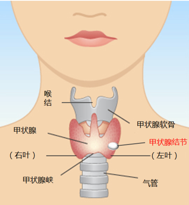 大庆市甲状腺癌占人口的多少_大庆市地图(2)