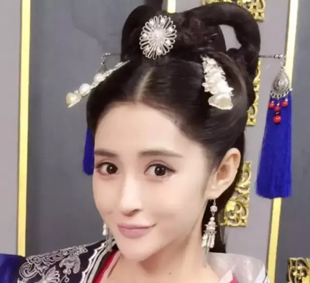 原因2:内眦赘皮(睑裂宽度)