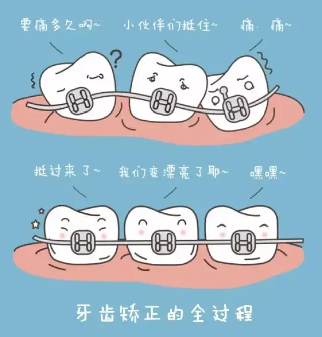 牙齿矫正包括范围较广,通常是指通过口腔技术手段,修整牙列排列不齐