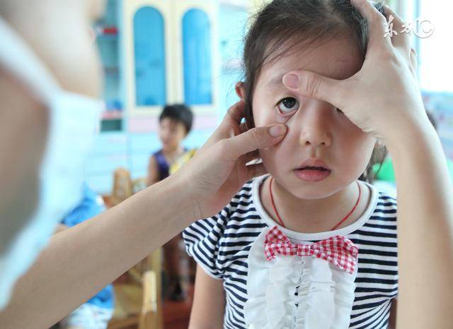 得了红眼病别着慌，如治疗错误会更加重病情！