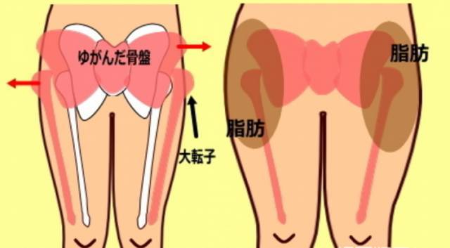 经常盘腿或是翘脚的人就特别容易盆骨突出哦,因此在平时生活中,姐妹