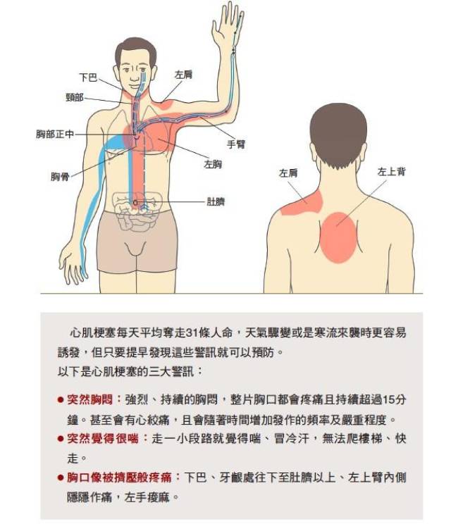 心肌梗塞的三大警报,你一定要知道