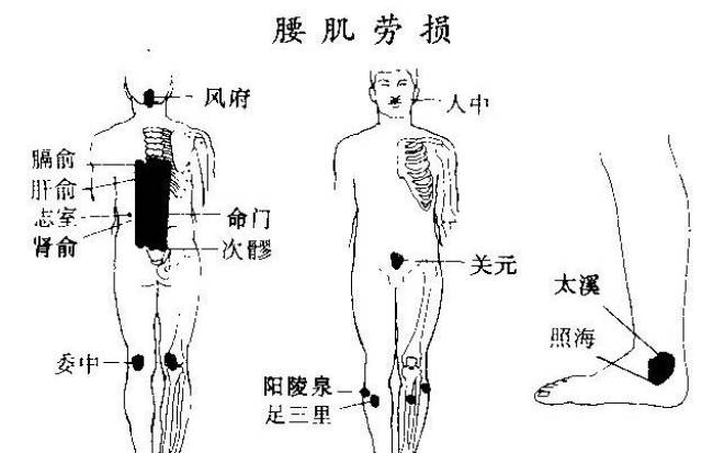 国医正骨:患了腰肌劳损,一个比治疗更重要的事情