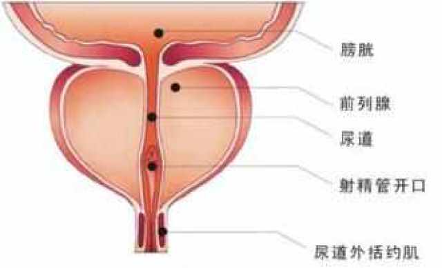 前列腺平时只有栗子大小,但当它生病的时候,可能会变成鸡蛋,橘子