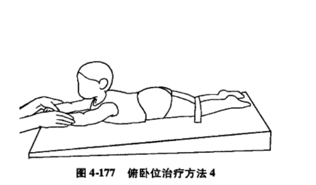 肌张力低下型脑瘫患儿的作业治疗方法(举例汇总)