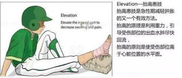 elevation: 抬高患肢,将患部抬高以利血液可以利用重力回流心脏,所以