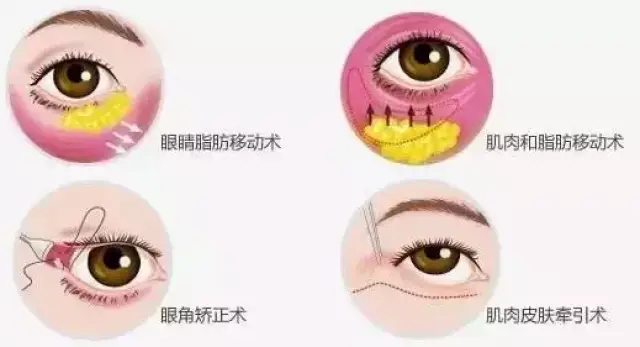 08abe6b281cc434d8e85788f7059e3cb.jpg