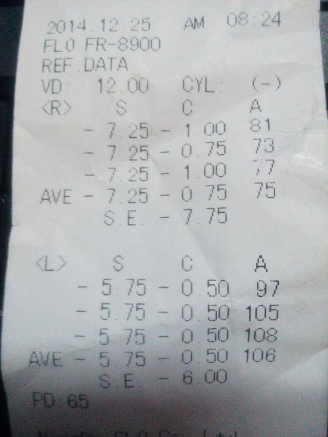 怎么自己测视力近视度数 881f8fe493fa4872b067f92536852218.jpeg