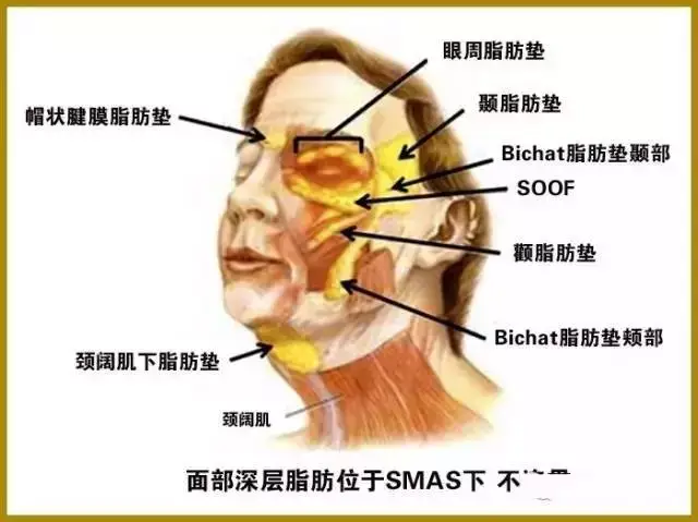 c:soof脂肪垫-----附着于眼轮匝肌 容易下垂:会形成泪沟,眼袋,并且