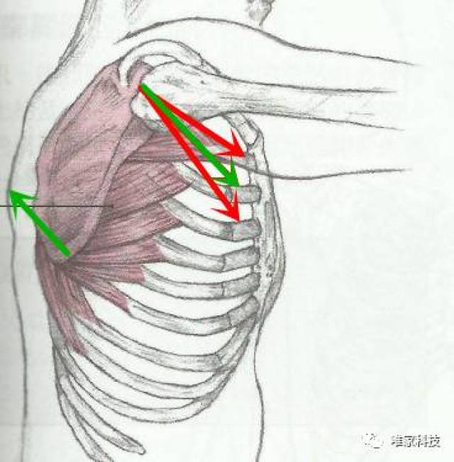 有副乳怎么办?