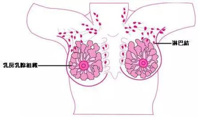 九个早期乳腺癌的迹象,不是手术刀能解决的问题!