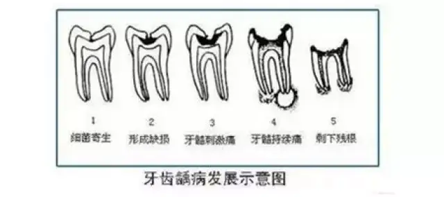 怎样才可以让牙变成原来的样子 0f9a6bd23a55428a8a08a35aaaff96bf.jpg