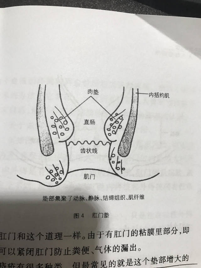 痔疮的基本常识——《痔疮的最佳诊治与护理》笔记