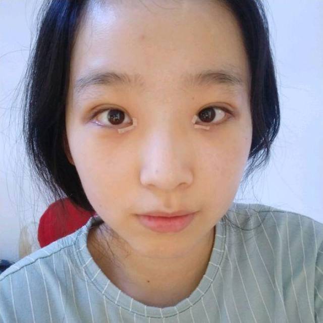 单眼皮对比照.