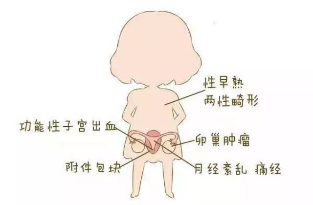 女人,你生命的各个阶段容易得这些妇科病!
