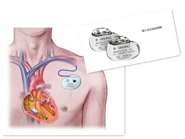4, 心脏起搏器