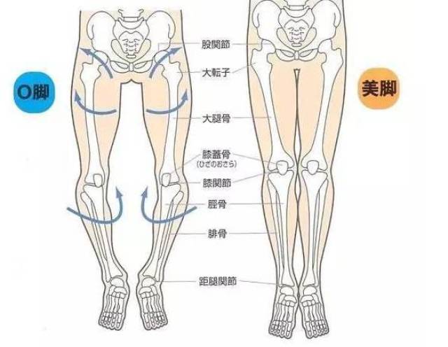 如何让宝宝避开罗圈腿_手机搜狐网