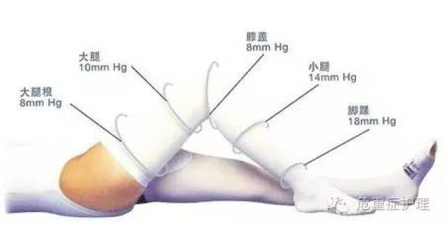 尽早进行功能锻炼,如:股四头肌锻炼和踝泵运动,早期下床活动以及深