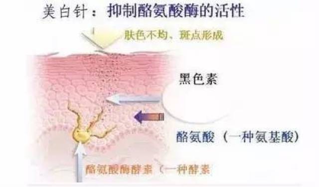 【悦惠美容】美白针 全面解读