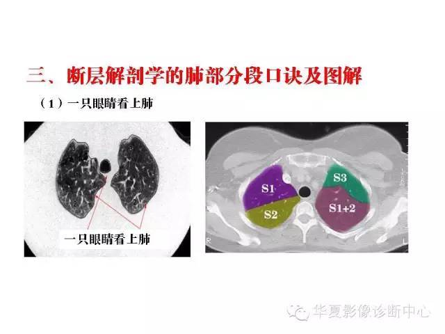 轻松掌握肺部解剖和分段