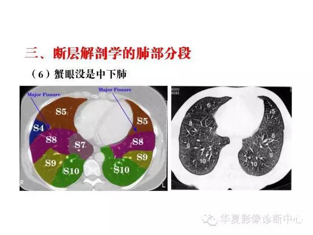 轻松掌握肺部解剖和分段