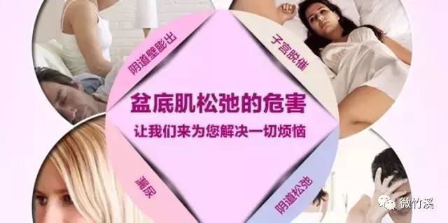 县妇幼保健院引进法国盆底康复仪,让产后妈妈更健康!