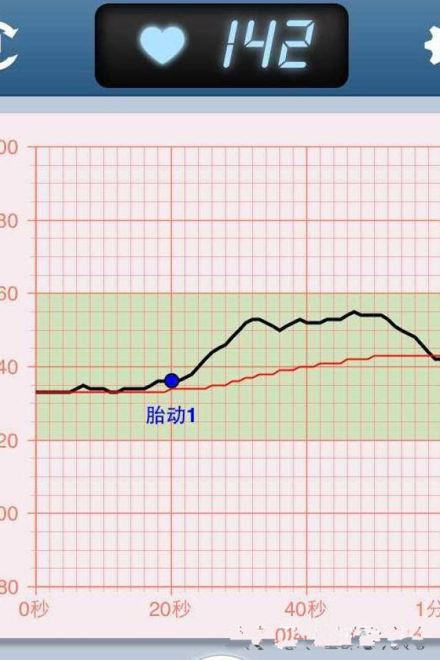 如果有以下情况的孕妈更要频繁进行胎心监测