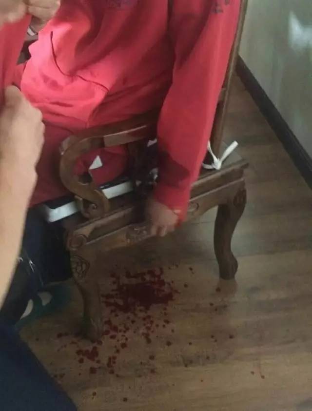 赤峰一男子割腕自杀!墙上留血书:死为厉鬼,血债血偿!