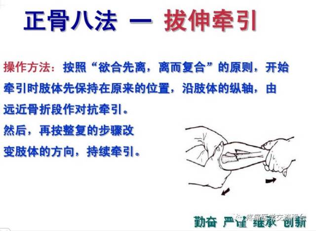 正骨八法