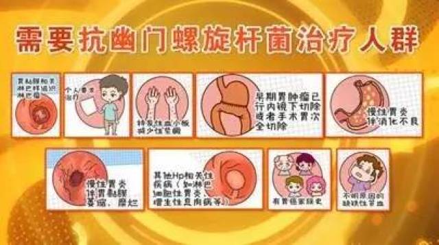 胃癌,或生活在胃癌高发区,成年后建议检查并进行根除幽门螺旋杆菌治疗