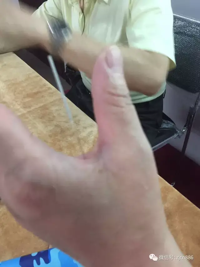 2,董氏奇穴放血疗法示范 3,共同讨论董氏奇穴的学习体会.