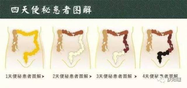 便秘是癌症的种子!将军肚,老年斑,肠癌等都与便秘有关