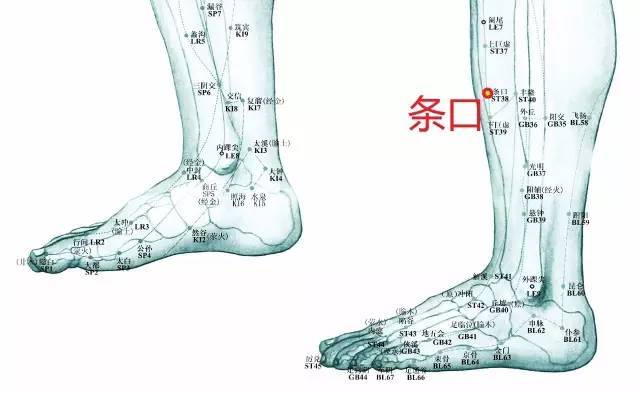 手法:毫针直刺2~2.5寸透承山. 对症:珑臂痛.