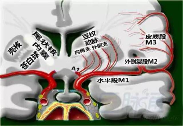 左侧大脑中动脉冠状位示意图